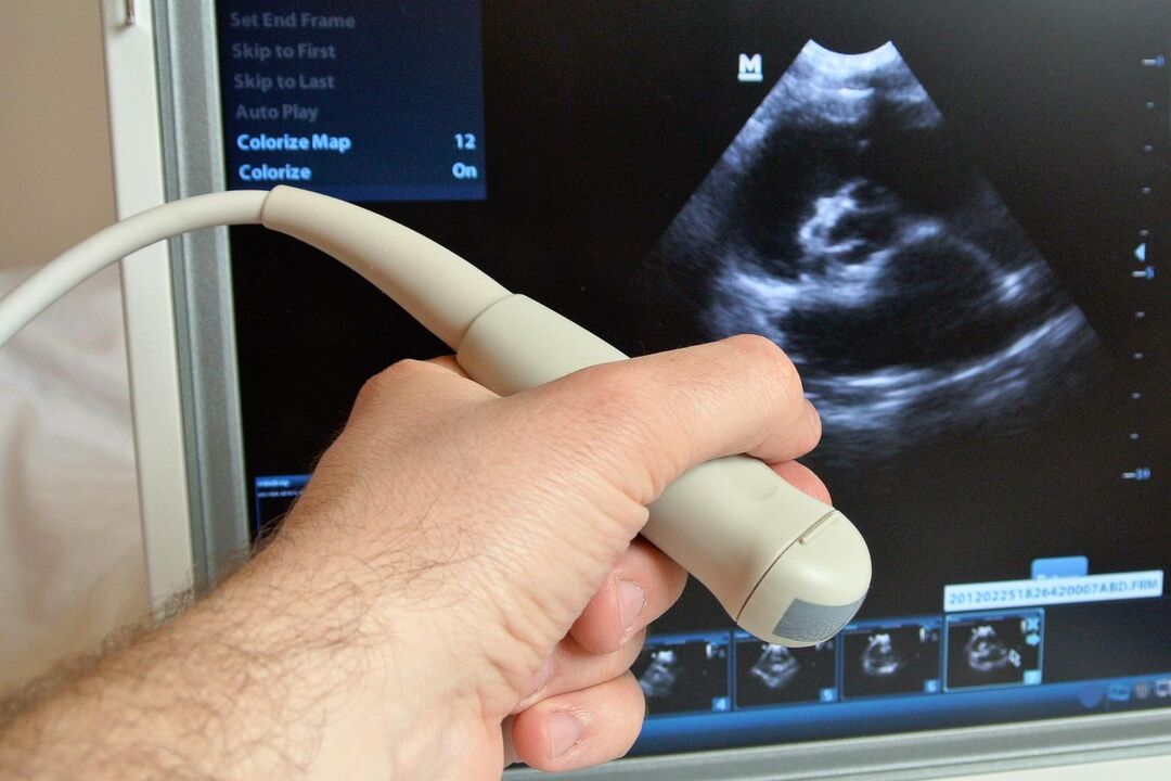 O ultrasonido axudará a diagnosticar a prostatite conxestiva nun home