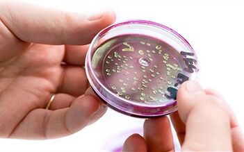 Bacterias na secreción da próstata